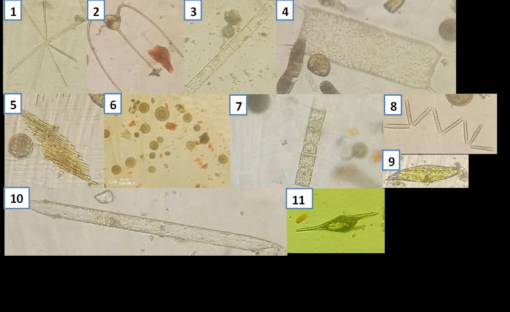 Planche de spécimens de phytoplancton observés au microscope, numérotés de 1 à 11